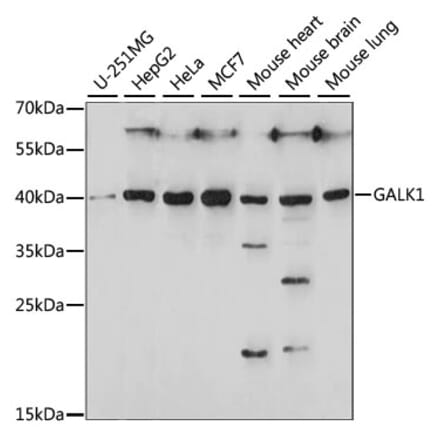 Western Blot - Anti-GALK1 Antibody (A89812) - Antibodies.com