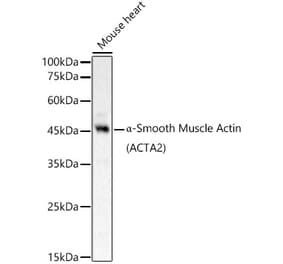 Western Blot - Anti-alpha smooth muscle Actin Antibody (A89813) - Antibodies.com