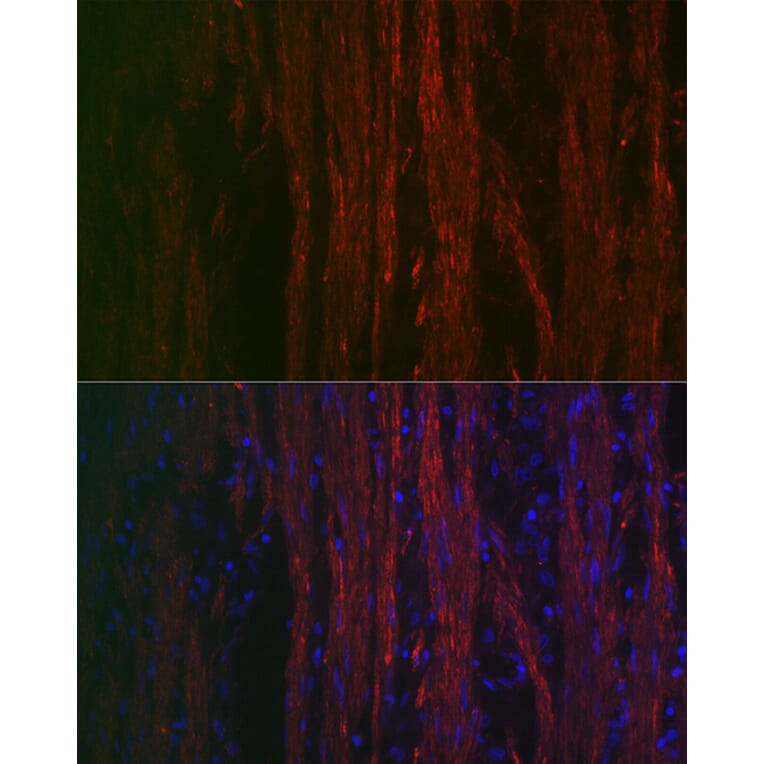 Immunofluorescence - Anti-alpha smooth muscle Actin Antibody (A89813) - Antibodies.com