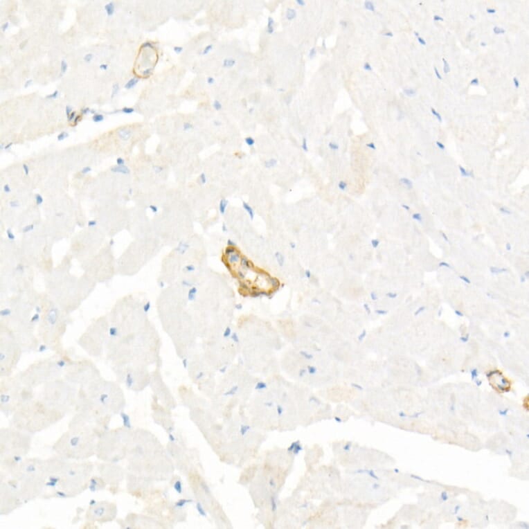 Immunohistochemistry - Anti-alpha smooth muscle Actin Antibody (A89813) - Antibodies.com