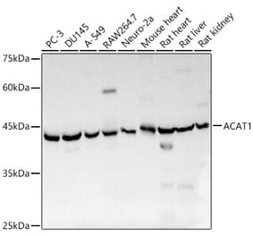 Western Blot - Anti-ACAT1 Antibody (A89814) - Antibodies.com