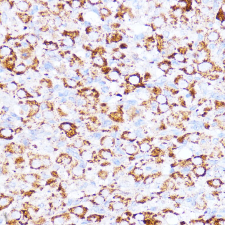 Immunohistochemistry - Anti-ACAT1 Antibody (A89814) - Antibodies.com