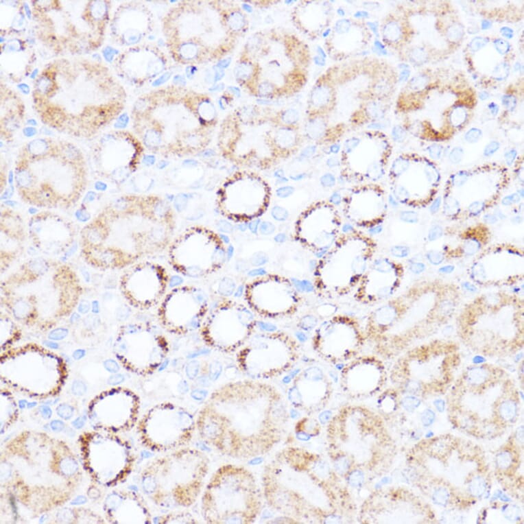 Immunohistochemistry - Anti-ACAT1 Antibody (A89814) - Antibodies.com