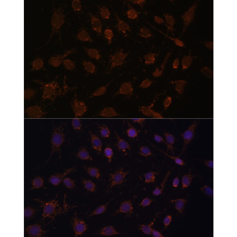 Immunofluorescence - Anti-ACAT1 Antibody (A89814) - Antibodies.com