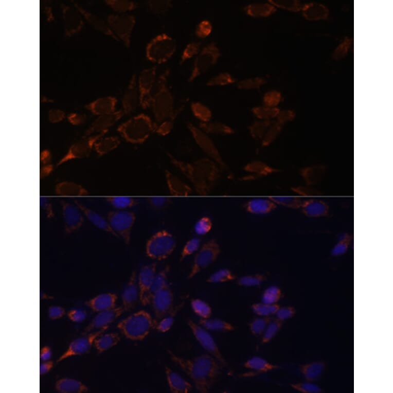 Immunofluorescence - Anti-ACAT1 Antibody (A89814) - Antibodies.com