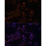 Immunofluorescence - Anti-ACAT1 Antibody (A89814) - Antibodies.com