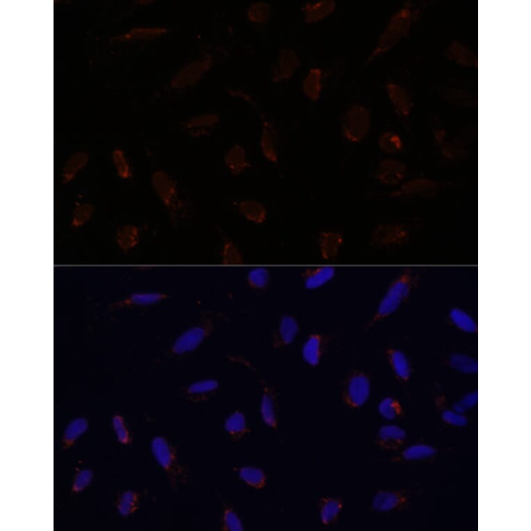 Immunofluorescence - Anti-ACAT1 Antibody (A89814) - Antibodies.com