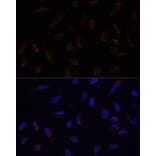Immunofluorescence - Anti-ACAT1 Antibody (A89814) - Antibodies.com