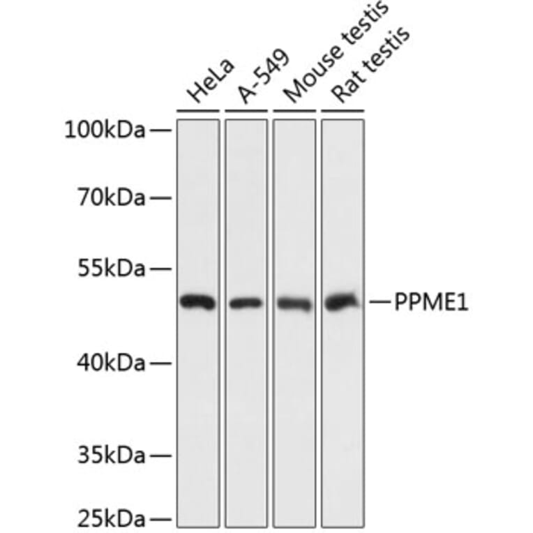 Western Blot - Anti-PME-1 Antibody (A89815) - Antibodies.com