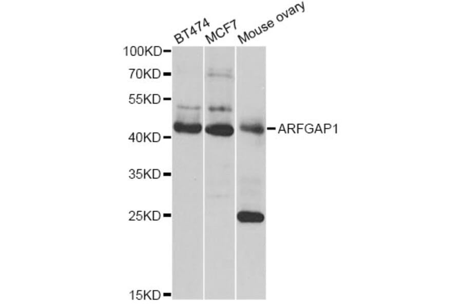 Western Blot - Anti-ARFGAP1 Antibody (A12595) - Antibodies.com