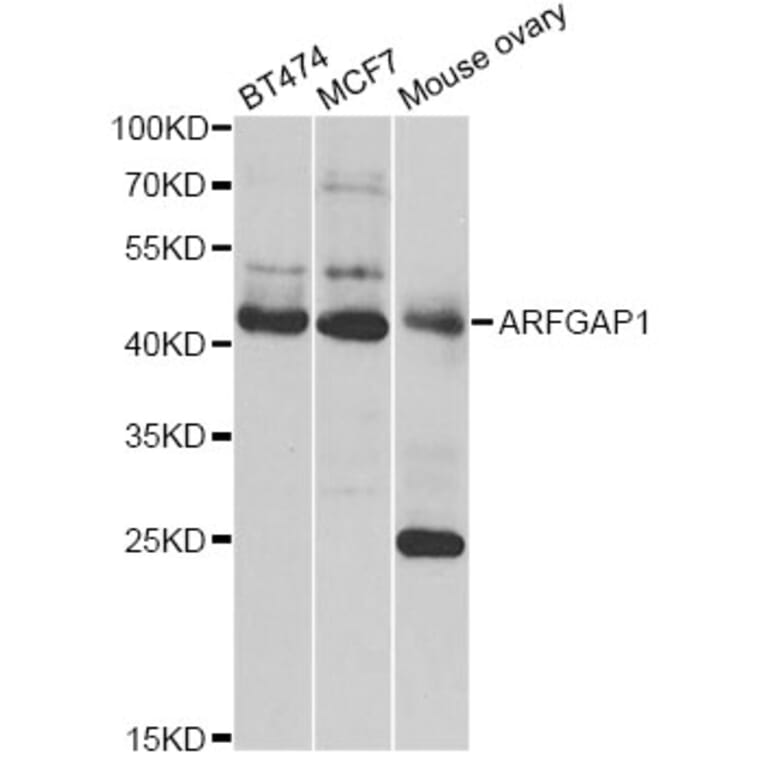 Western Blot - Anti-ARFGAP1 Antibody (A12595) - Antibodies.com