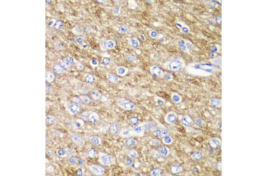 Immunohistochemistry - Anti-ARFGAP1 Antibody (A12595) - Antibodies.com