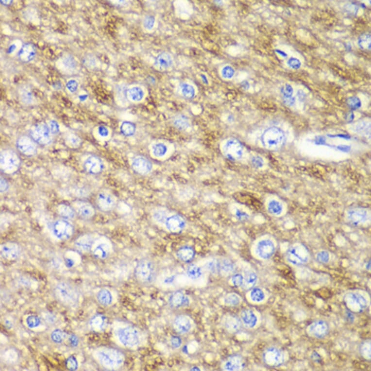 Immunohistochemistry - Anti-ARFGAP1 Antibody (A12595) - Antibodies.com