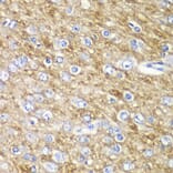 Immunohistochemistry - Anti-ARFGAP1 Antibody (A12595) - Antibodies.com