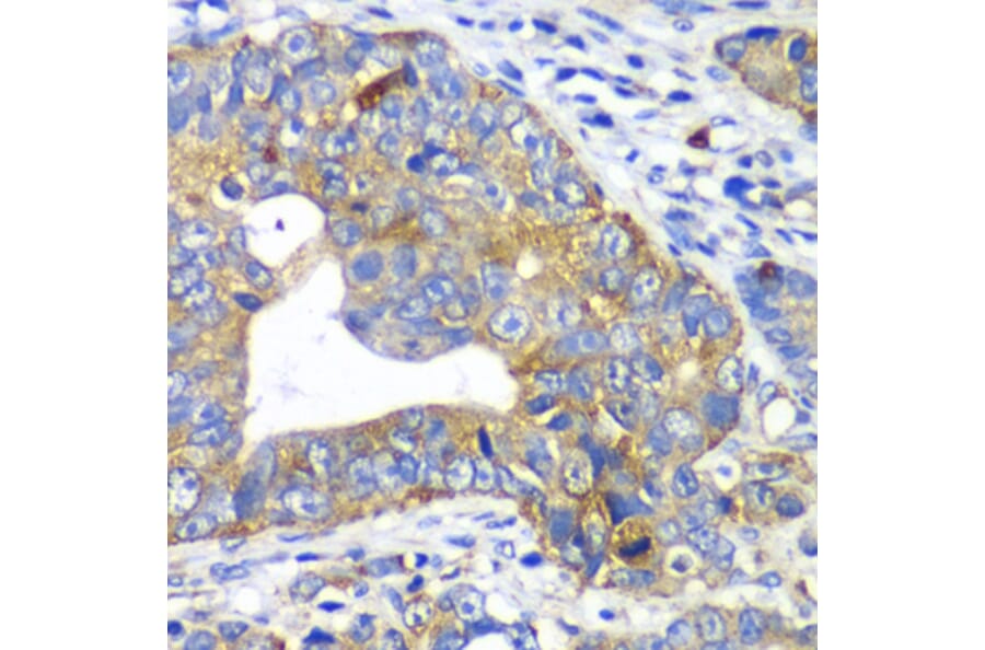 Immunohistochemistry - Anti-ARFGAP1 Antibody (A12595) - Antibodies.com