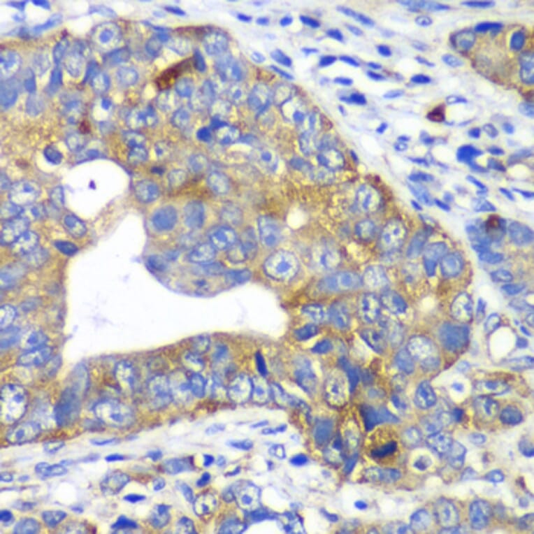 Immunohistochemistry - Anti-ARFGAP1 Antibody (A12595) - Antibodies.com
