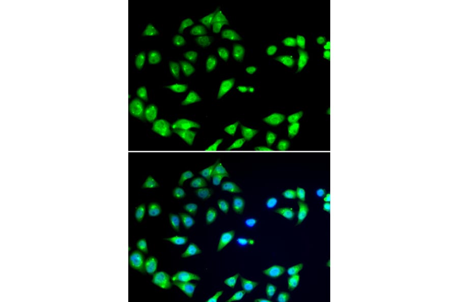 Immunofluorescence - Anti-ARFGAP1 Antibody (A12595) - Antibodies.com