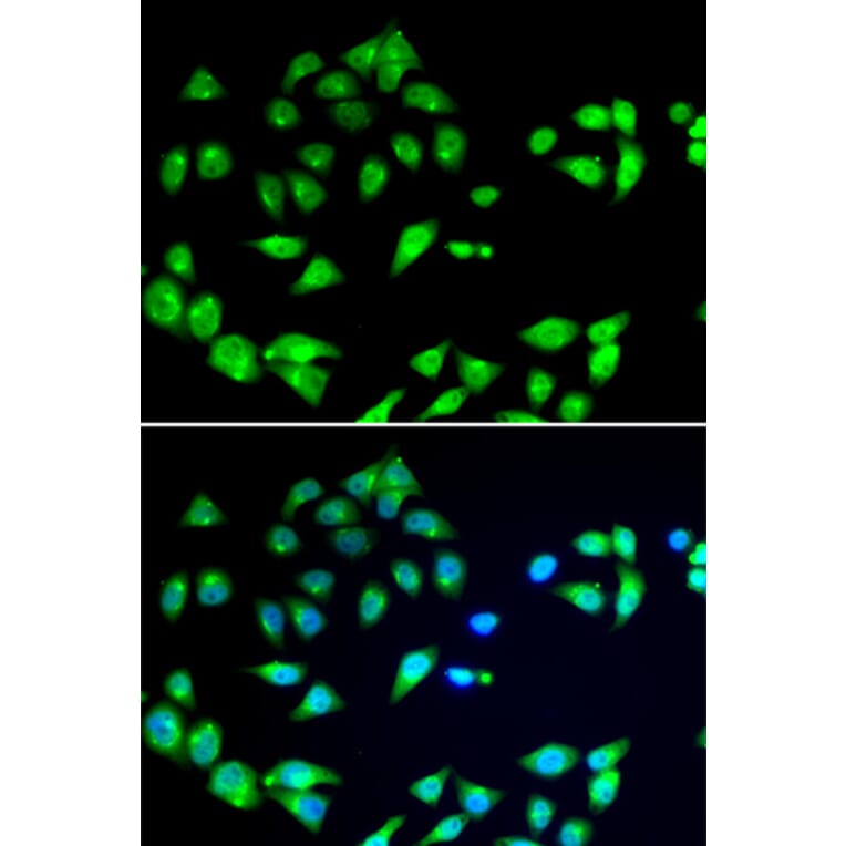 Immunofluorescence - Anti-ARFGAP1 Antibody (A12595) - Antibodies.com