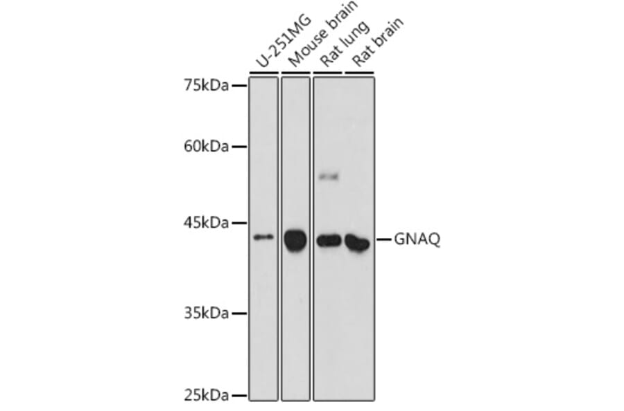 Western Blot - Anti-GNAQ Antibody (A89819) - Antibodies.com