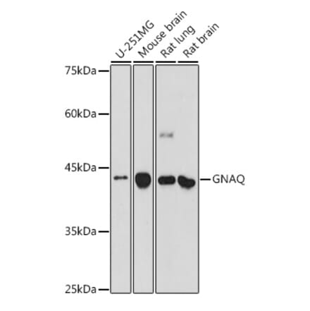 Western Blot - Anti-GNAQ Antibody (A89819) - Antibodies.com