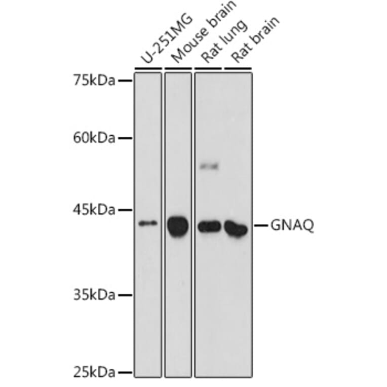 Western Blot - Anti-GNAQ Antibody (A89819) - Antibodies.com