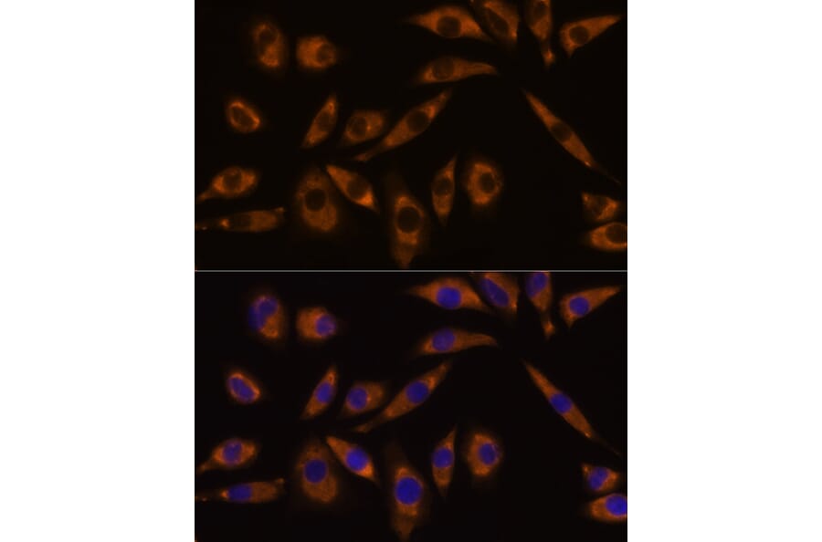 Immunofluorescence - Anti-GNAQ Antibody (A89819) - Antibodies.com
