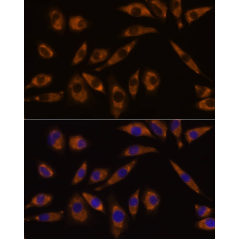 Immunofluorescence - Anti-GNAQ Antibody (A89819) - Antibodies.com