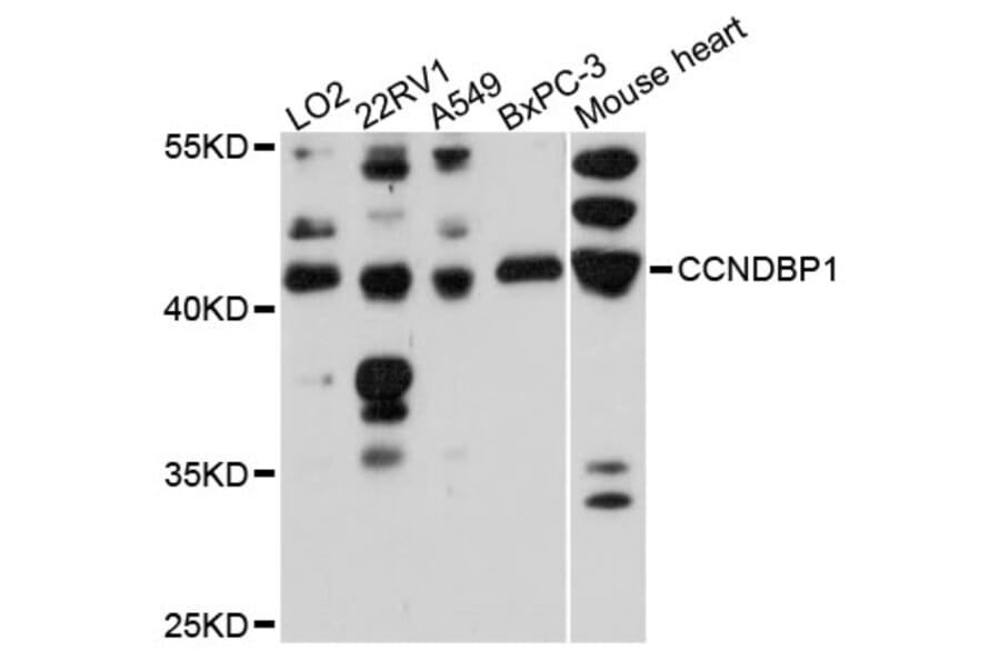 Western Blot - Anti-CCNDBP1 Antibody (A13735) - Antibodies.com