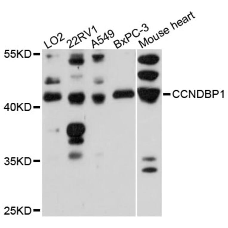 Western Blot - Anti-CCNDBP1 Antibody (A13735) - Antibodies.com