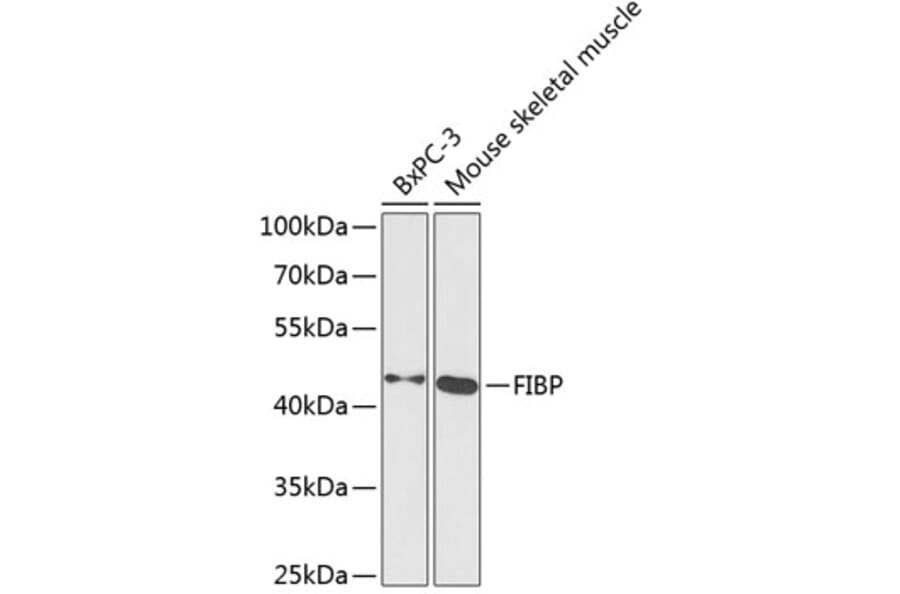 Western Blot - Anti-FIBP Antibody (A89821) - Antibodies.com