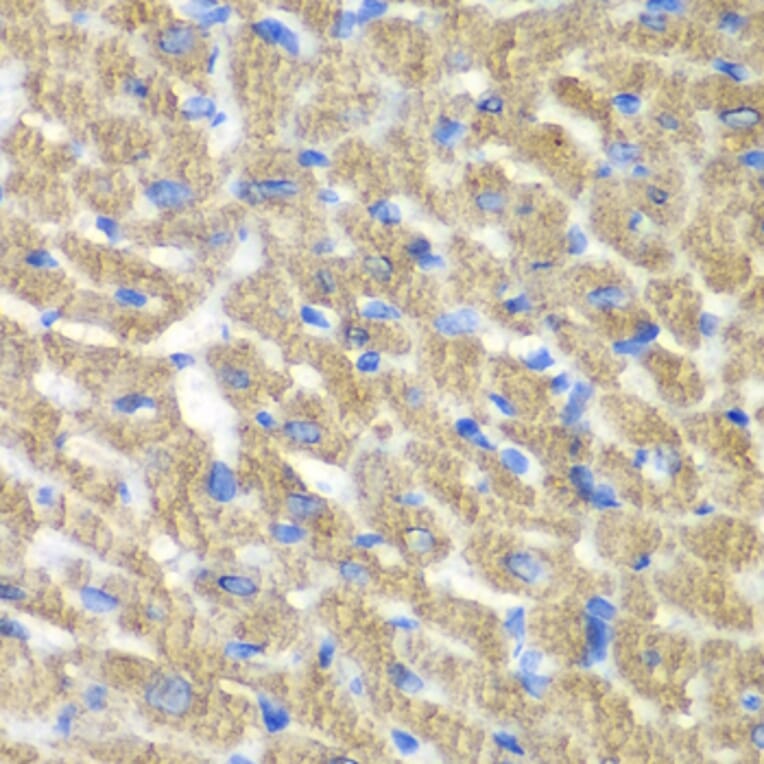 Immunohistochemistry - Anti-FIBP Antibody (A89821) - Antibodies.com