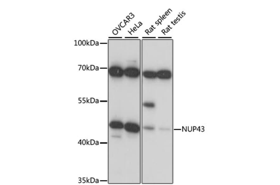 Western Blot - Anti-NUP43 Antibody (A89823) - Antibodies.com