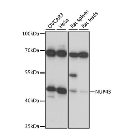 Western Blot - Anti-NUP43 Antibody (A89823) - Antibodies.com