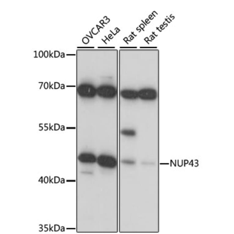 Western Blot - Anti-NUP43 Antibody (A89823) - Antibodies.com