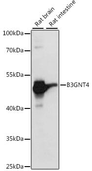 Western blot analysis of extracts of various cell lines, using Anti-B3GNT4 Antibody (A15896) at 1:1,000 dilution.
Secondary antibody: Goat Anti-Rabbit IgG (H+L) (HRP) (AS014) at 1:10,000 dilution.
Lysates / proteins: 25µg per lane.
Blocking buffer: 3% non-fat dry milk in TBST.
Detection: ECL Basic Kit (RM00020).
Exposure time: 5s.
