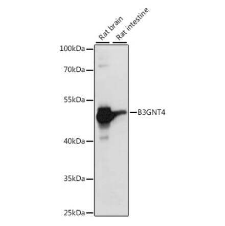 Western Blot - Anti-B3GNT4 Antibody (A89824) - Antibodies.com