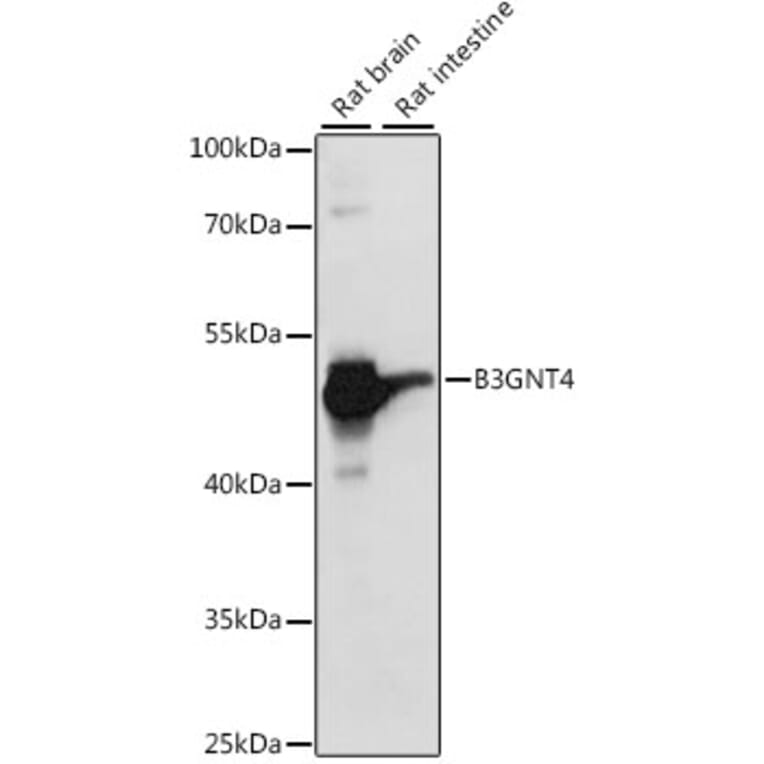 Western Blot - Anti-B3GNT4 Antibody (A89824) - Antibodies.com