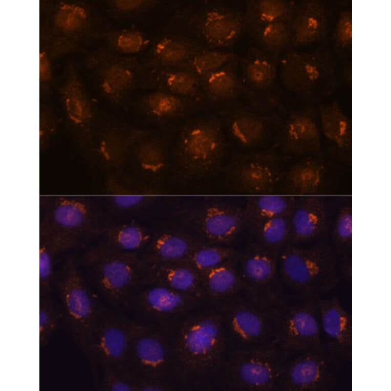 Immunofluorescence - Anti-B3GNT4 Antibody (A89824) - Antibodies.com