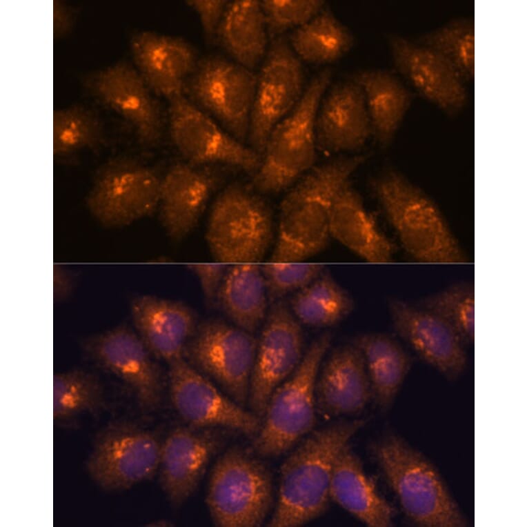Immunofluorescence - Anti-B3GNT4 Antibody (A89824) - Antibodies.com