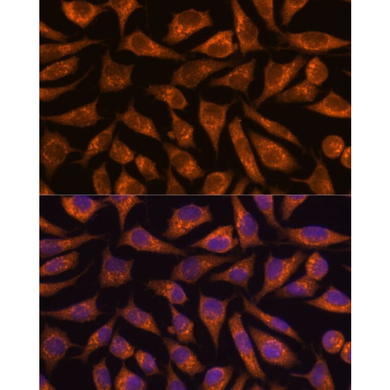 Immunofluorescence - Anti-B3GNT4 Antibody (A89824) - Antibodies.com