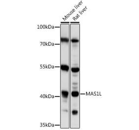 Western Blot - Anti-MAS1L Antibody (A89825) - Antibodies.com