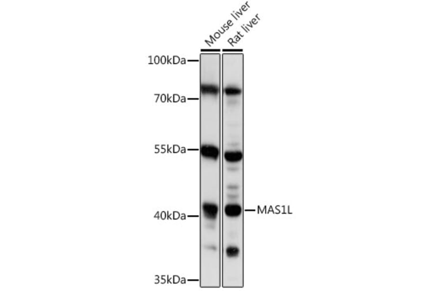 Western Blot - Anti-MAS1L Antibody (A89825) - Antibodies.com