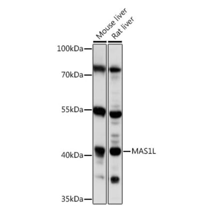 Western Blot - Anti-MAS1L Antibody (A89825) - Antibodies.com