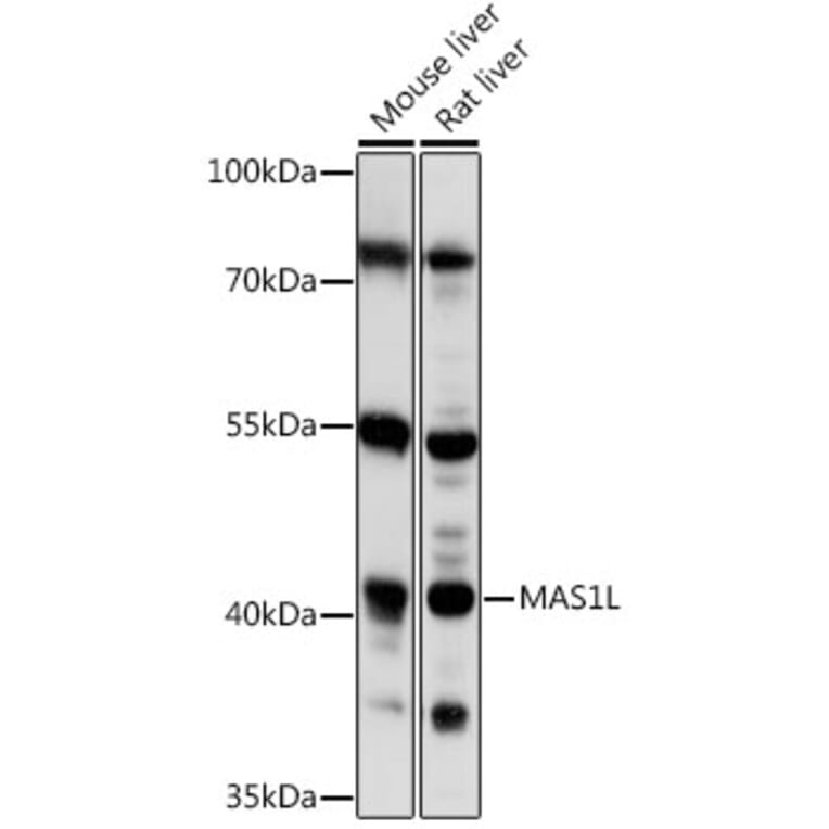 Western Blot - Anti-MAS1L Antibody (A89825) - Antibodies.com