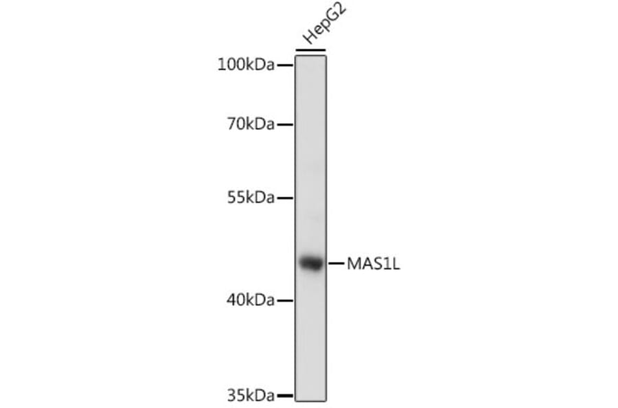 Western Blot - Anti-MAS1L Antibody (A89826) - Antibodies.com