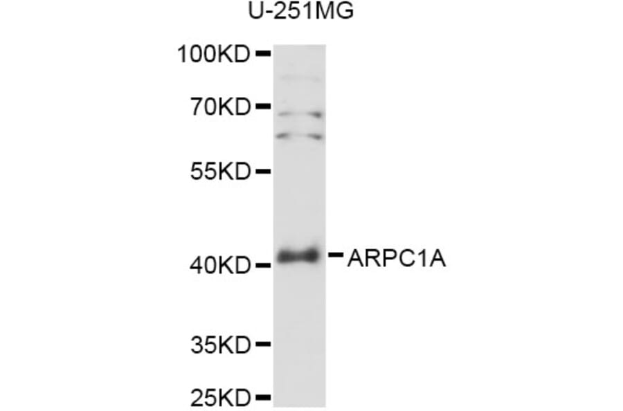 Western Blot - Anti-ARPC1A Antibody (A14502) - Antibodies.com
