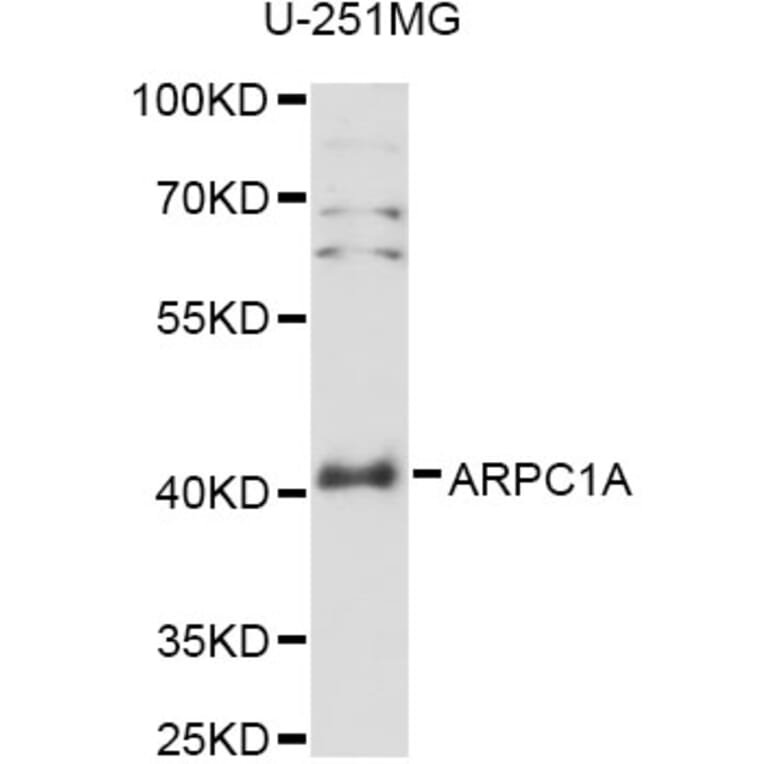 Western Blot - Anti-ARPC1A Antibody (A14502) - Antibodies.com