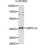 Western Blot - Anti-ARPC1A Antibody (A14502) - Antibodies.com
