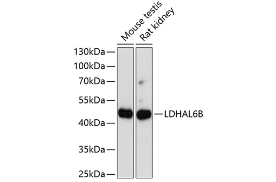 Western Blot - Anti-LDHAL6B Antibody (A89828) - Antibodies.com