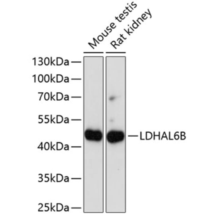 Western Blot - Anti-LDHAL6B Antibody (A89828) - Antibodies.com